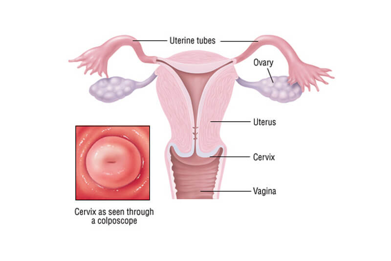 About Cervical Cancer