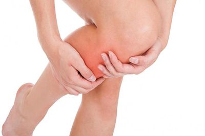 cervical cancer leg pain