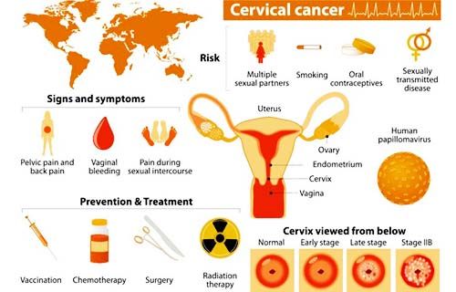 cervical cancer targeted therapy